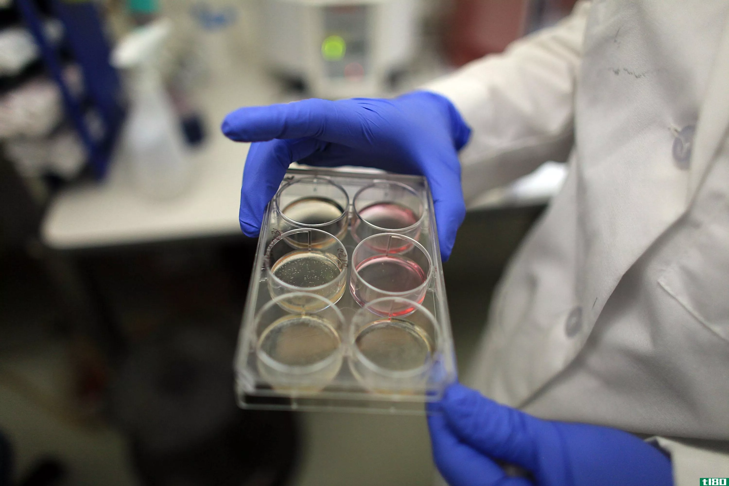 新型干细胞可能使人类胚胎的研究更容易