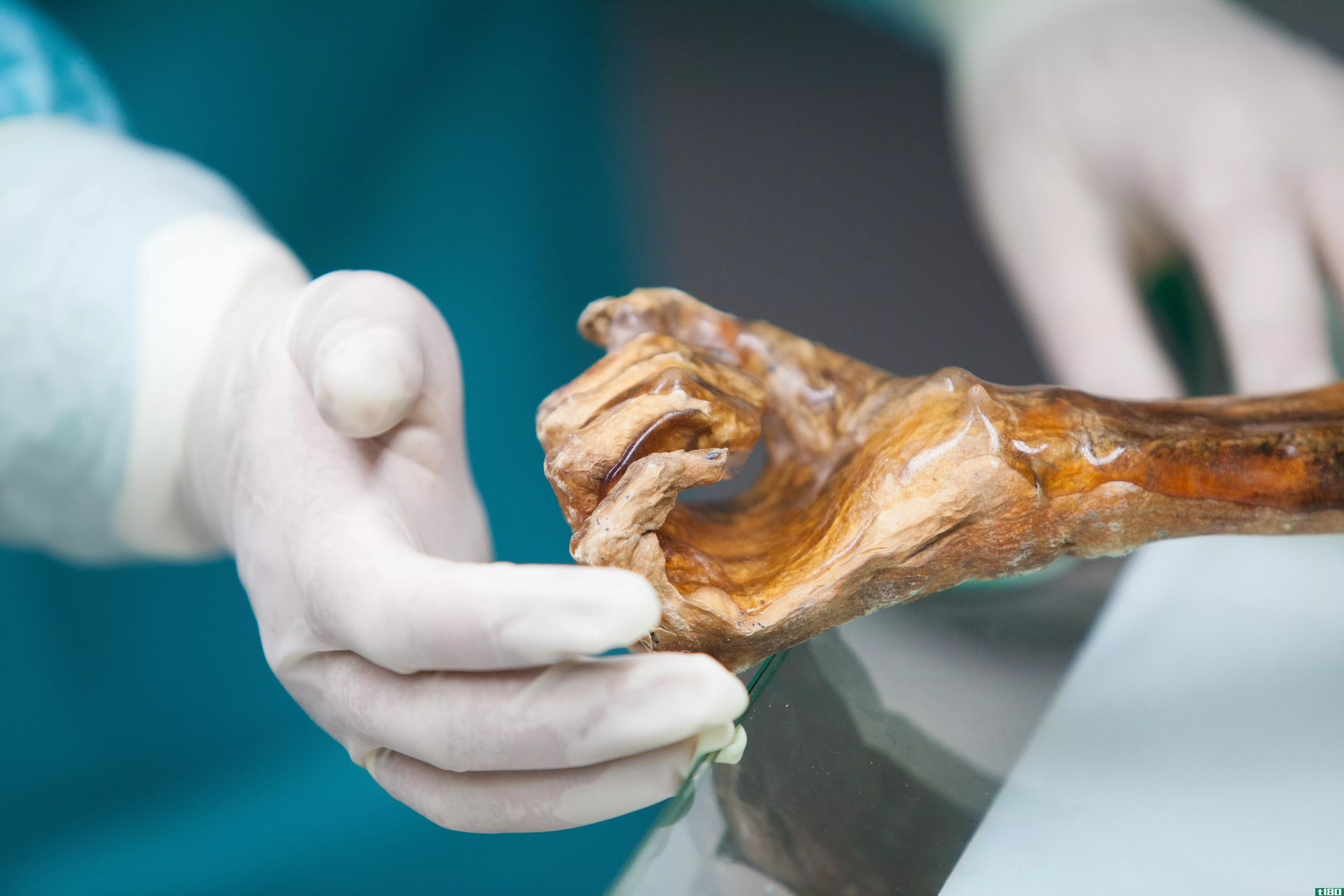 我们能从一具5300年前冰川木乃伊的内脏中学到什么？
