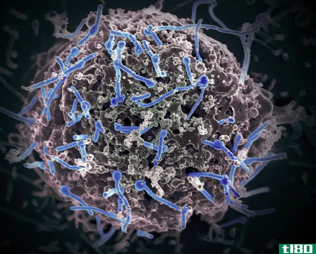 9个月后在一些男性精液中发现埃博拉病毒