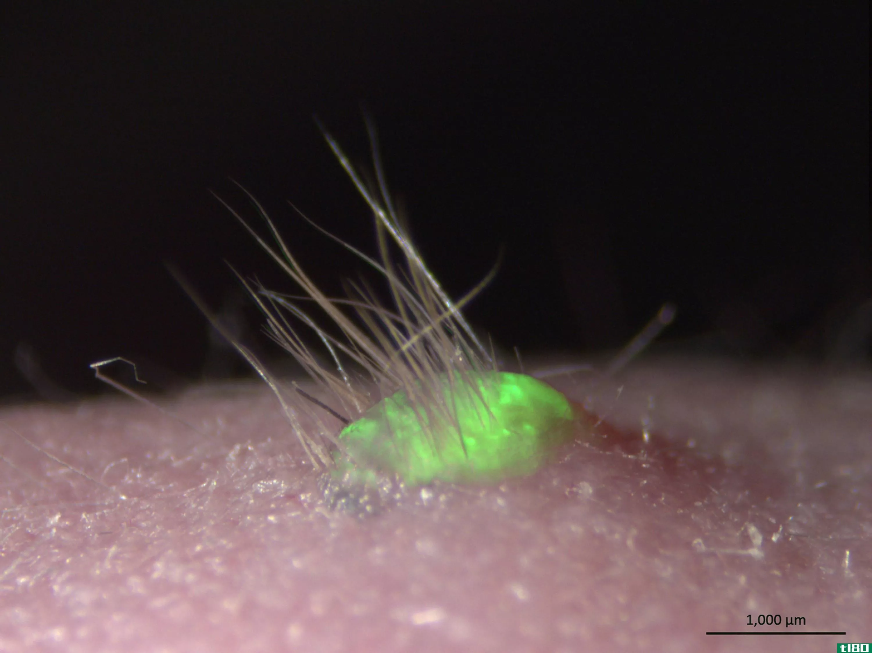 科学家们用干细胞培育出多毛的荧光皮肤进行移植