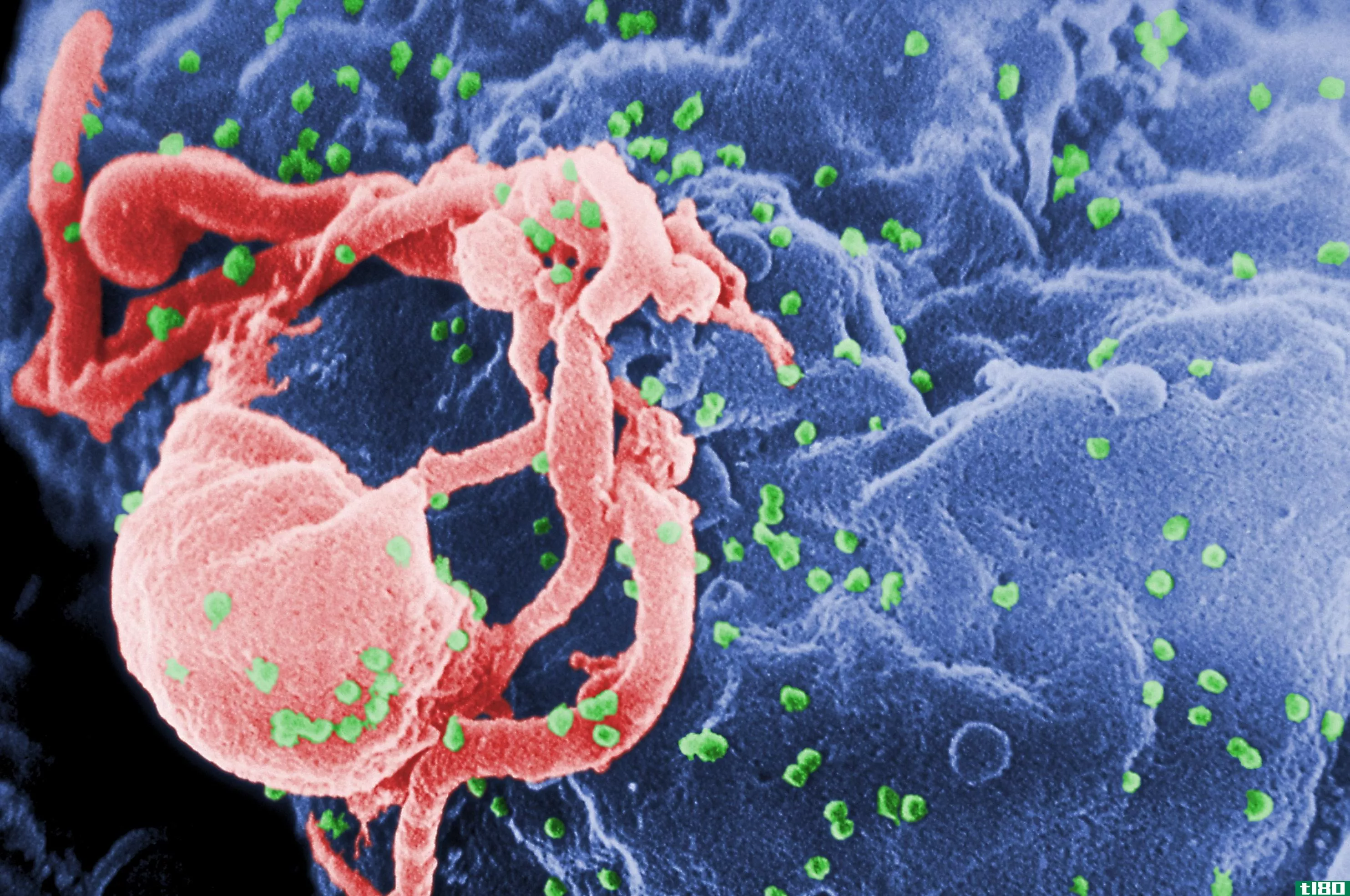 科学家辟谣艾滋病患者零