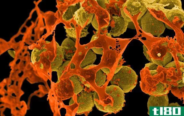在人类鼻子里发现了新的抗超级细菌抗生素