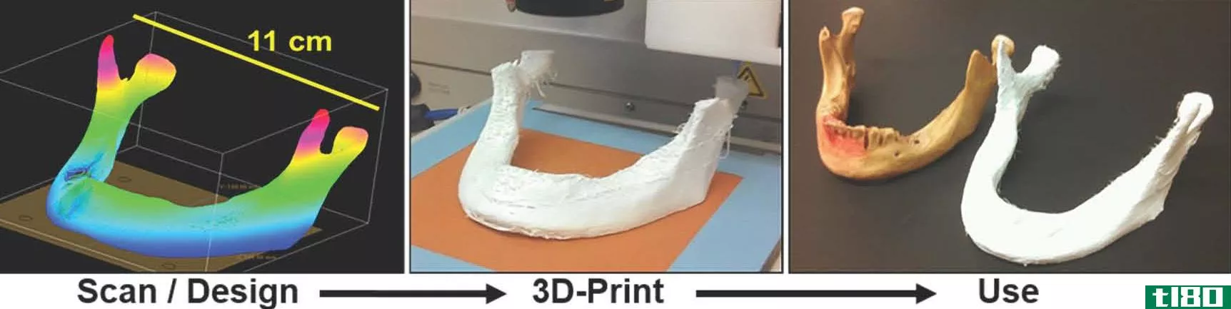 3d打印的“超弹性骨”可能是重建手术的未来