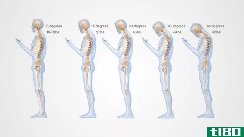 Illustration for article titled This Is What Looking Down at Your Cell Phone Does to Your Spine