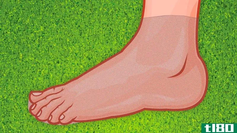 Illustration for article titled Prevent Blisters When Running or Hiking with Pantyhose Bottoms