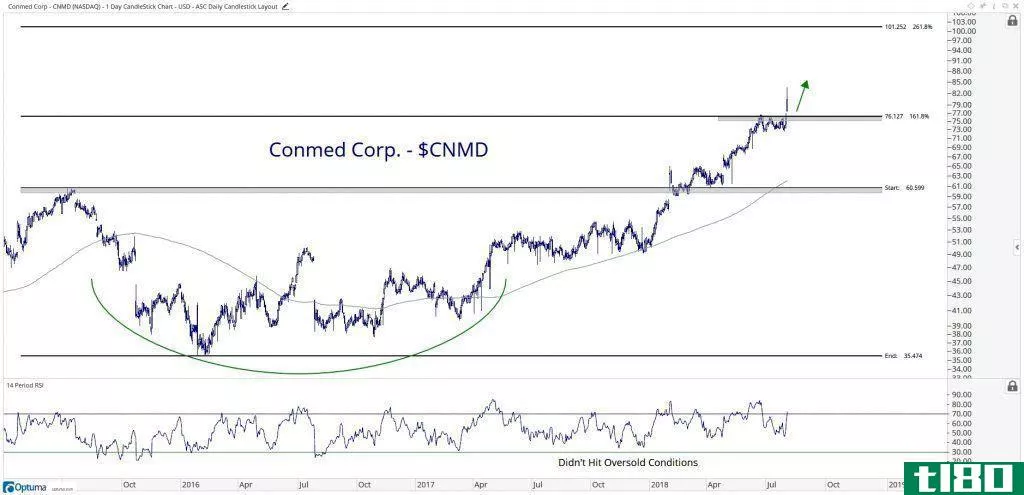 Chart showing the performance of CONMED Corporation (CNMD) stock