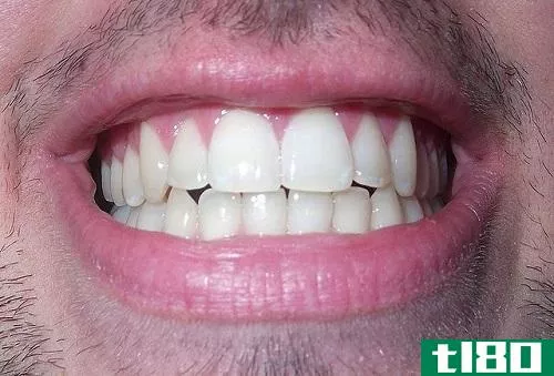 牙齿(the tooth)和牙齿(teeth)的区别