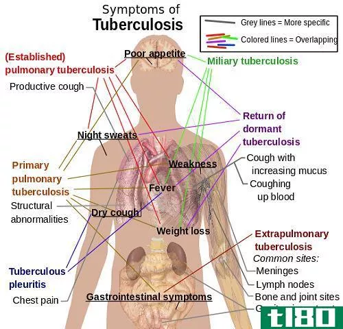 肺炎(pneumonia)和肺结核(tuberculosis)的区别