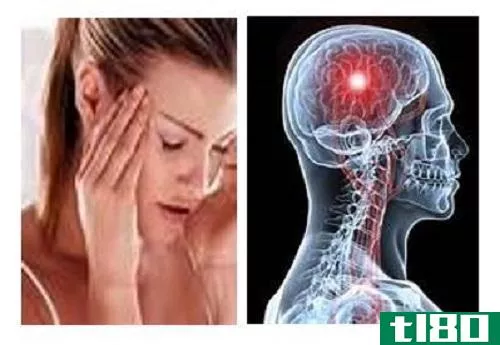 偏头痛(migraine)和(打、击等的)一下(stroke)的区别