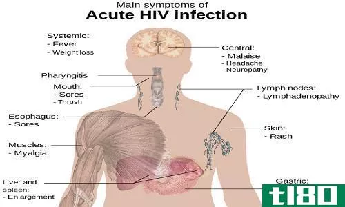艾滋病毒/艾滋病(hiv/aids)和流感(flu)的区别