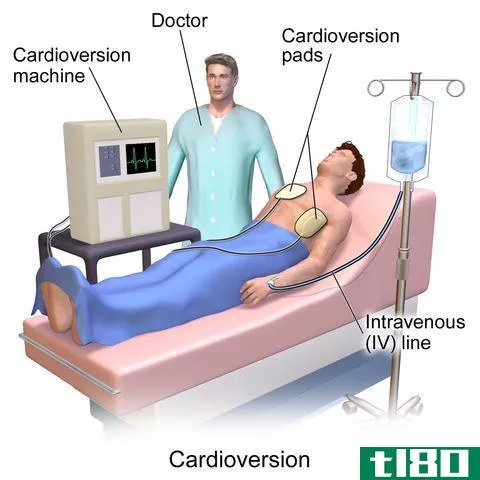 心脏复律(cardioversion)和除颤(defibrillation)的区别