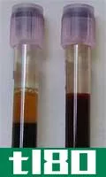 等离子体(plasma)和血清(serum)的区别