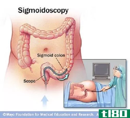 乙状结肠镜(sigmoidoscopy)和结肠镜检查(colonoscopy)的区别