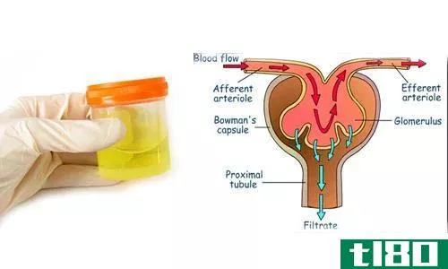 尿(urine)和滤液(filtrate)的区别