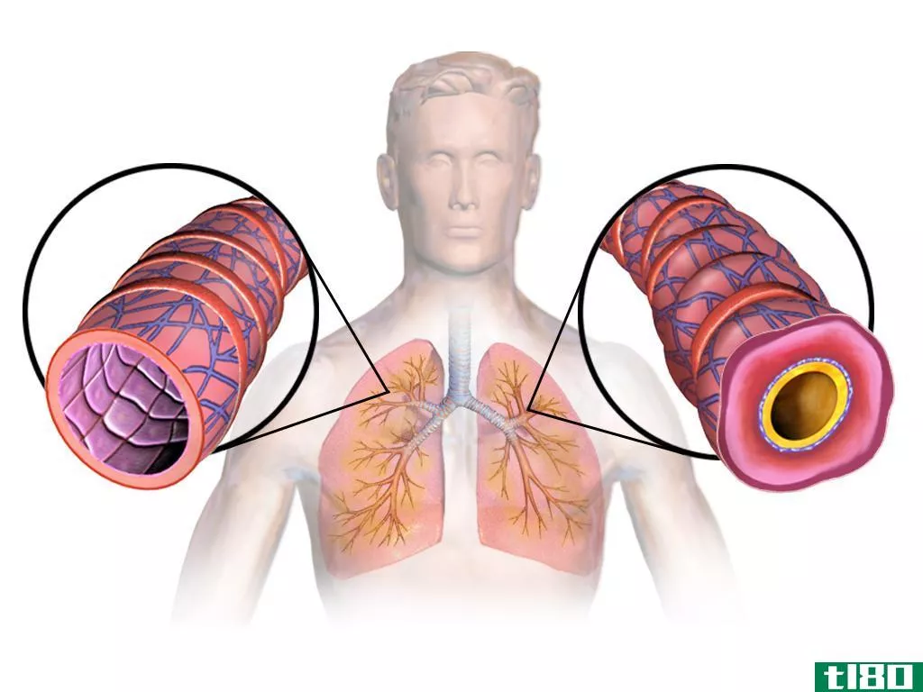 哮喘(asthma)和反应性气道疾病(reactive airway disease)的区别