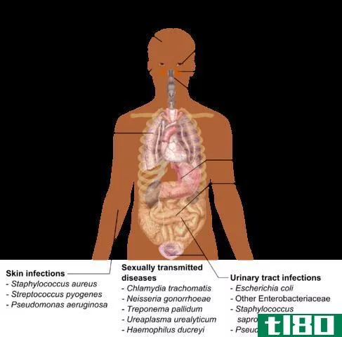 上呼吸道感染(upper respiratory infection)和支气管炎(bronchitis)的区别