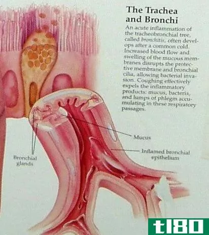 支气管炎(bronchitis)和喉炎(laryngitis)的区别