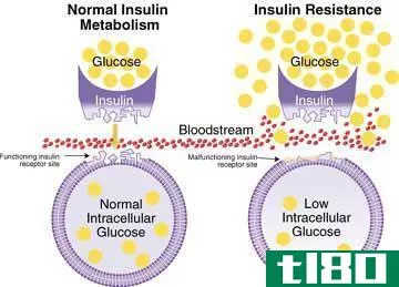 糖尿病(diabetes)和胰岛素抵抗(insulin resistance)的区别