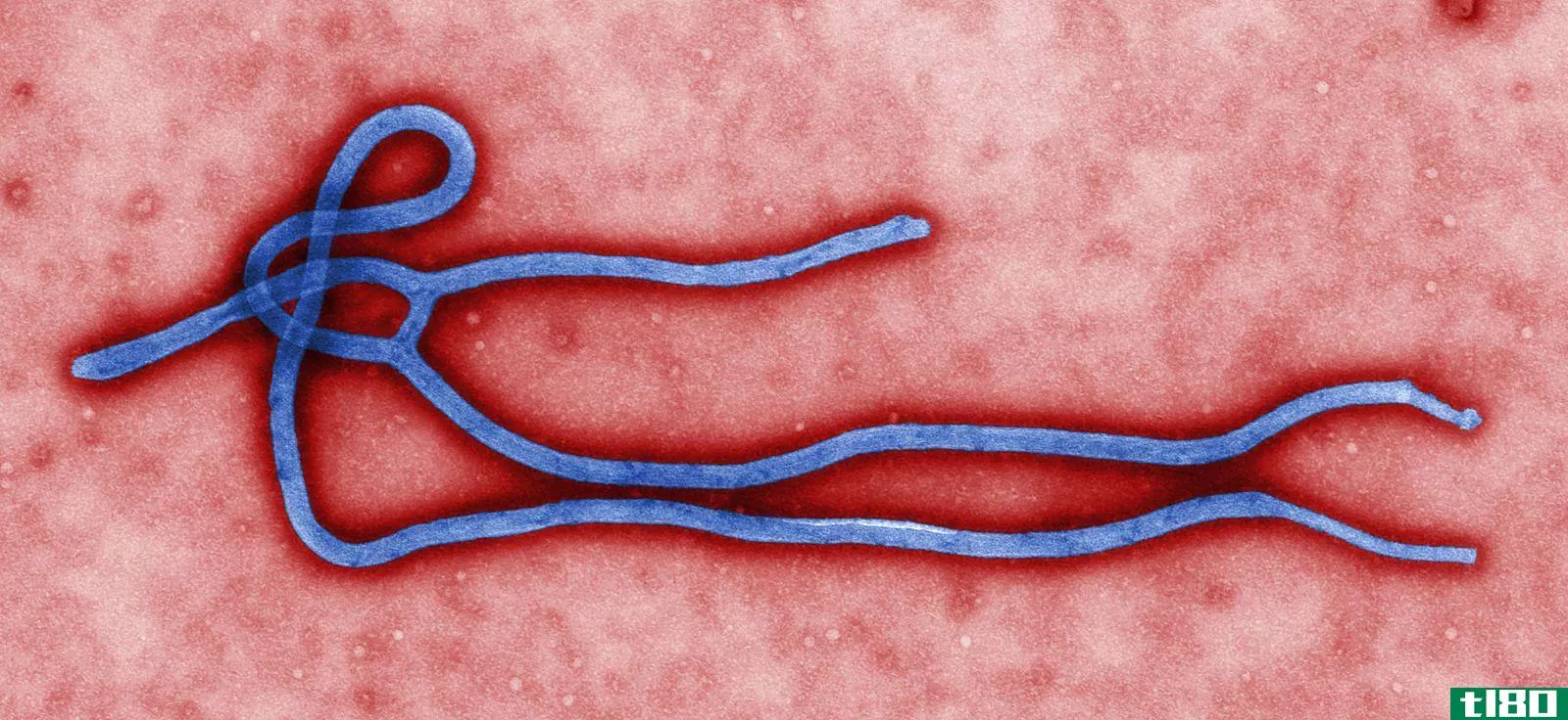 冠状病毒(coronavirus)和埃博拉病毒(ebola)的区别