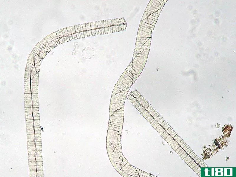 河孢(rivularia)和振荡(oscillatoria)的区别