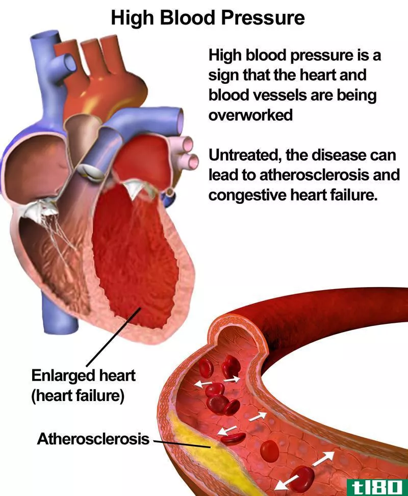 初级的(primary)和继发性高血压(secondary hypertension)的区别