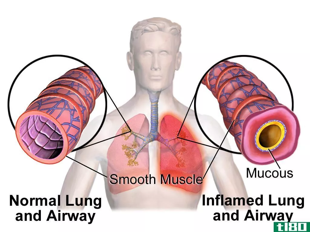 严重的(acute)和慢性哮喘恶化(chronic asthma exacerbation)的区别
