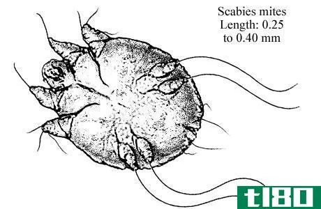 臭虫(bed bugs)和疥疮(scabies)的区别