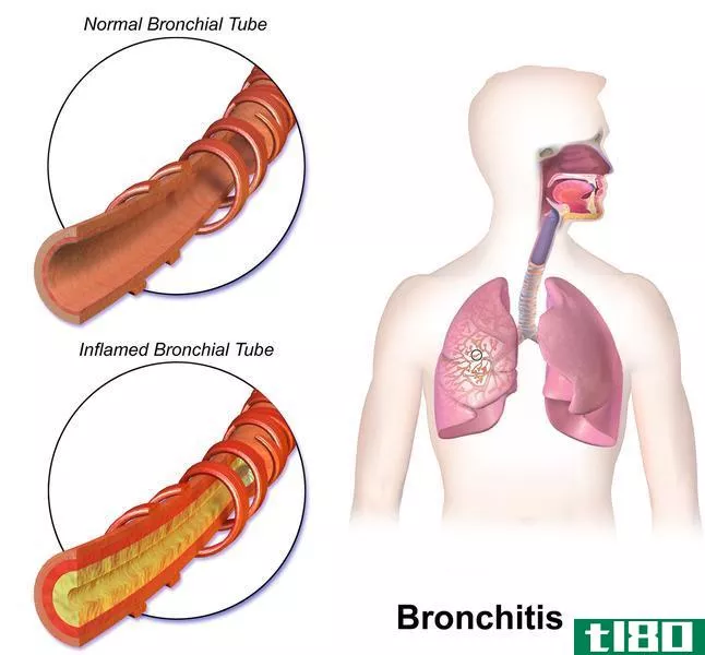 上呼吸道感染(upper respiratory infection)和支气管炎(bronchitis)的区别
