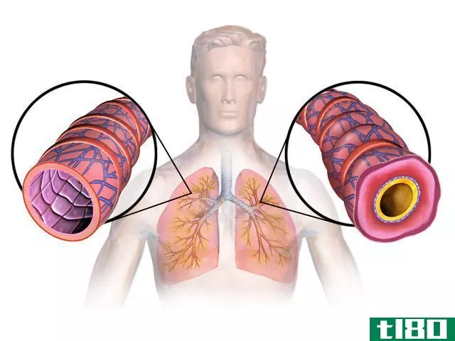 哮喘(asthma)和过敏(allergies)的区别